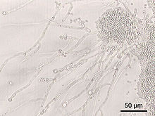 upload.wikimedia.org_wikipedia_commons_thumb_b_b6_Candida_albicans.jpg_220px_Candida_albicans.jpg